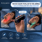 KALMIA — Dispositivo Inteligente Anti-Ronquidos